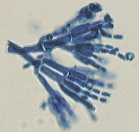 penic2.jpg (13992 octets)