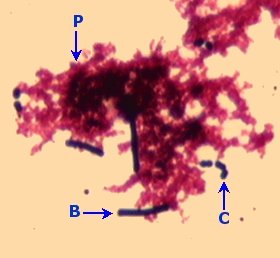 yaourt2.jpg (13628 octets)